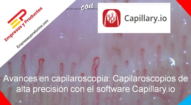 Capilaroscopios de alta precisión con el software Capillary.io